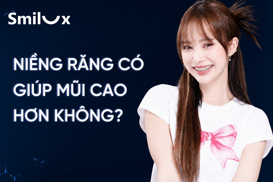 Niềng răng có giúp mũi cao hơn không? Bác sĩ Smilux giải đáp Niềng răng có giúp mũi cao hơn không? Bác sĩ Smilux giải đáp