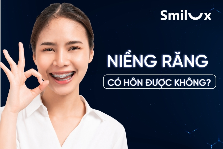 Niềng răng có hôn được không? Bác sĩ Smilux giải đáp chi tiết Niềng răng có hôn được không? Bác sĩ Smilux giải đáp chi tiết