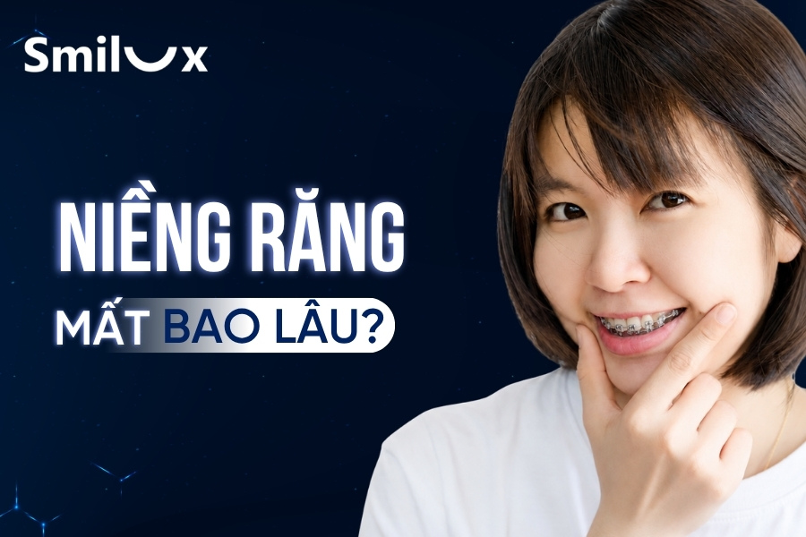 Thời gian niềng răng mất bao lâu thì xong? Các yếu tố ảnh hưởng Thời gian niềng răng mất bao lâu thì xong? Các yếu tố ảnh hưởng