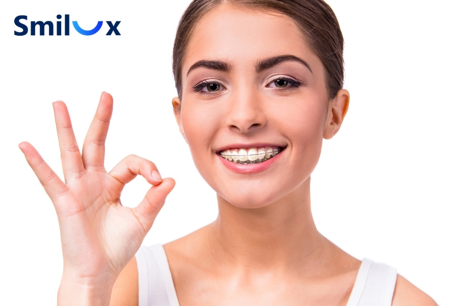 25 tuổi niềng răng được không? Câu trả lời là CÓ. 25 tuổi niềng răng được không? Câu trả lời là CÓ.