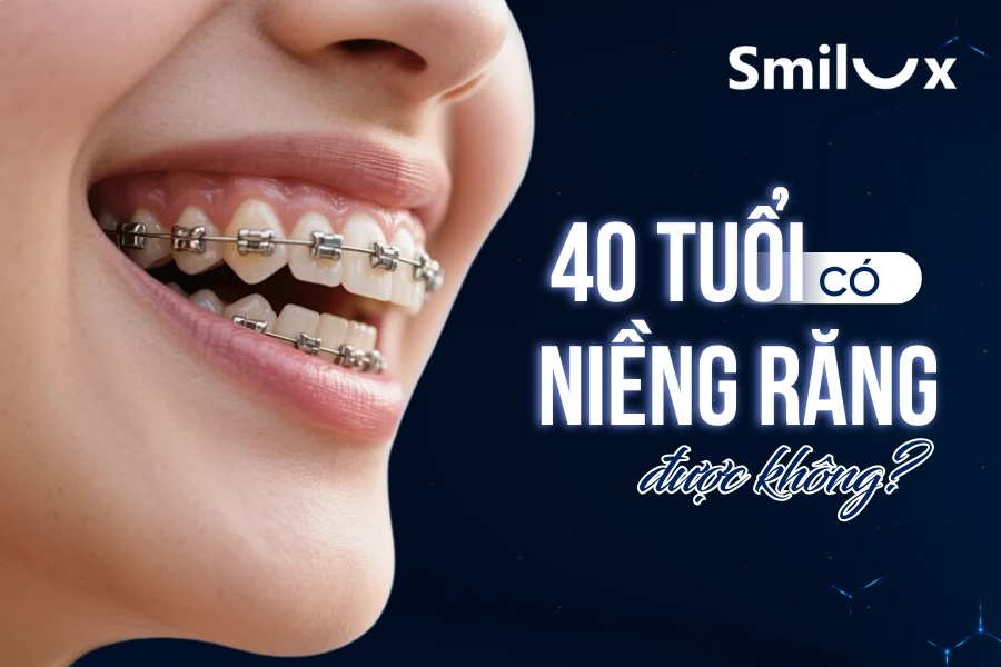 40 tuổi có niềng răng được không? Bác sĩ Smilux giải đáp chi tiết 40 tuổi có niềng răng được không? Bác sĩ Smilux giải đáp chi tiết