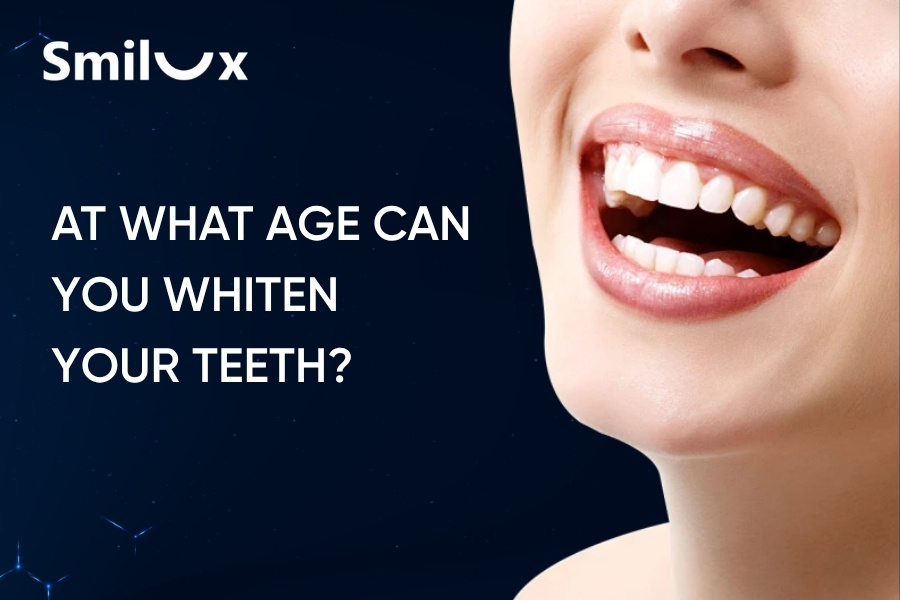 At What Age Can You Whiten Your Teeth? Should Children Have Their Teeth Whitened? At What Age Can You Whiten Your Teeth? Should Children Have Their Teeth Whitened?