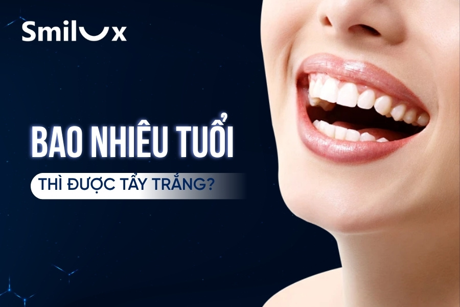 Bao nhiêu tuổi được tẩy trắng răng? Có nên tẩy trắng răng cho trẻ? Bao nhiêu tuổi được tẩy trắng răng? Có nên tẩy trắng răng cho trẻ? Bao nhiêu tuổi được tẩy trắng răng? Có nên tẩy trắng răng cho trẻ?
