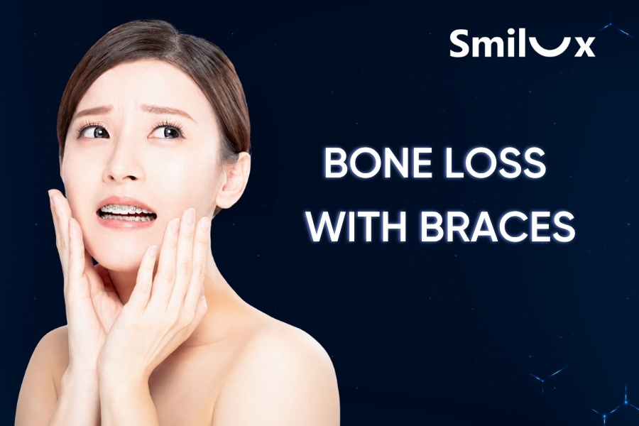 Bone Loss With Braces: Signs, Causes, and How to Fix It Bone Loss With Braces smilux dental