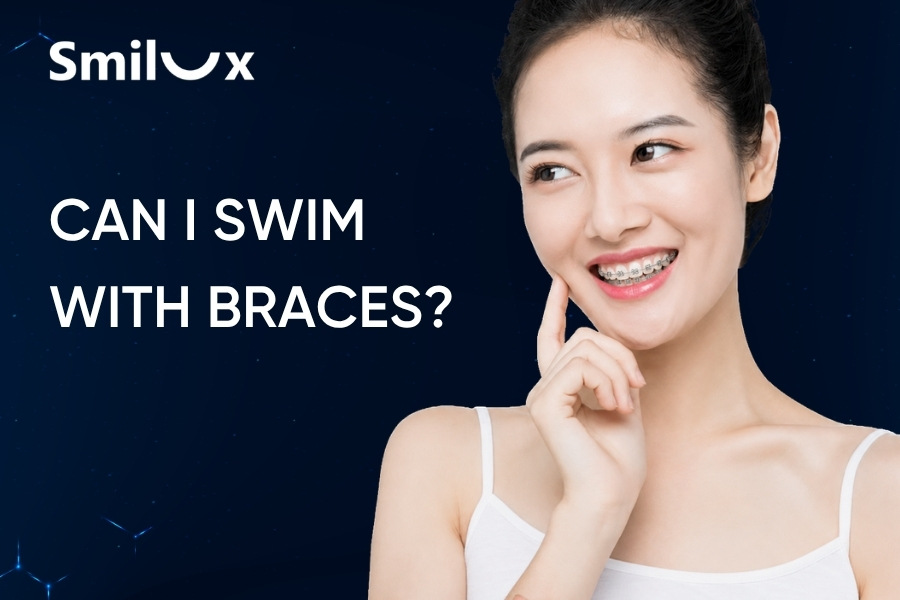 Can I Swim With Braces? Answers From Smilux Experts Can I Swim With Braces? Answers From Smilux Experts