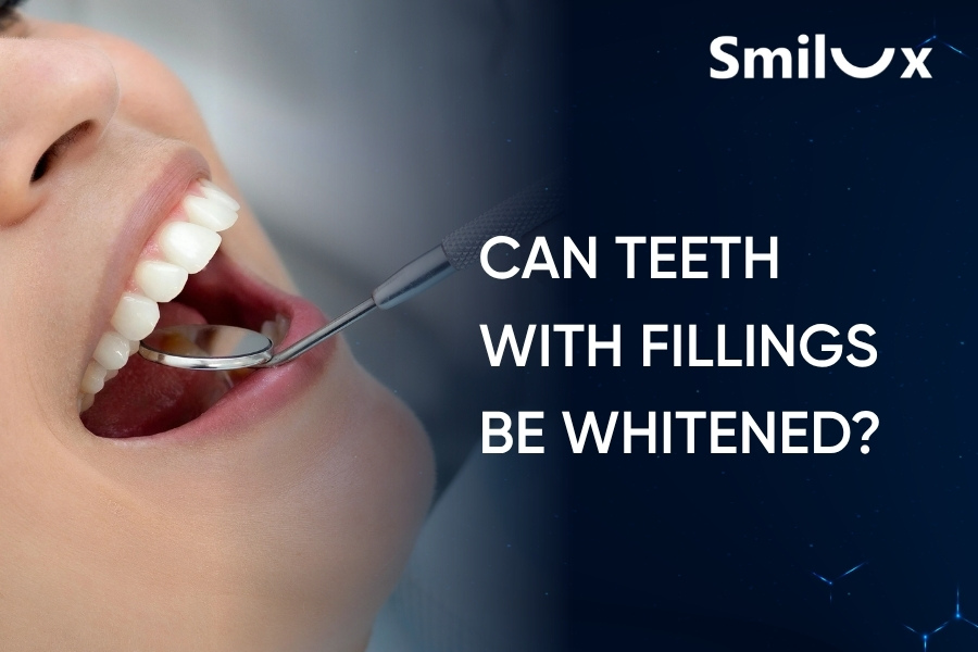 Can Teeth With Fillings Be Whitened? Advice from Smilux Dental Dentists