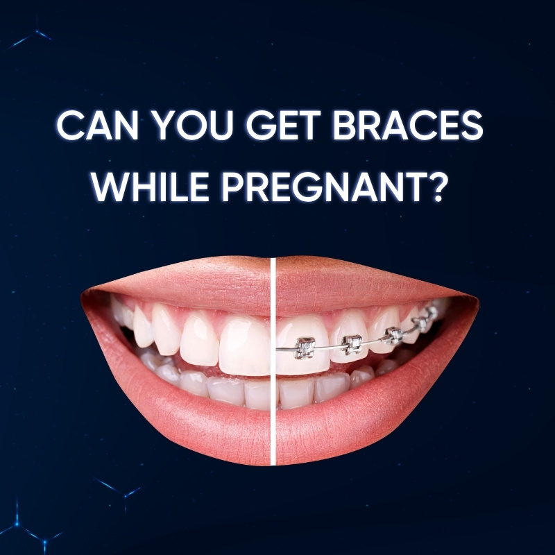Can You Get Braces While Pregnant?