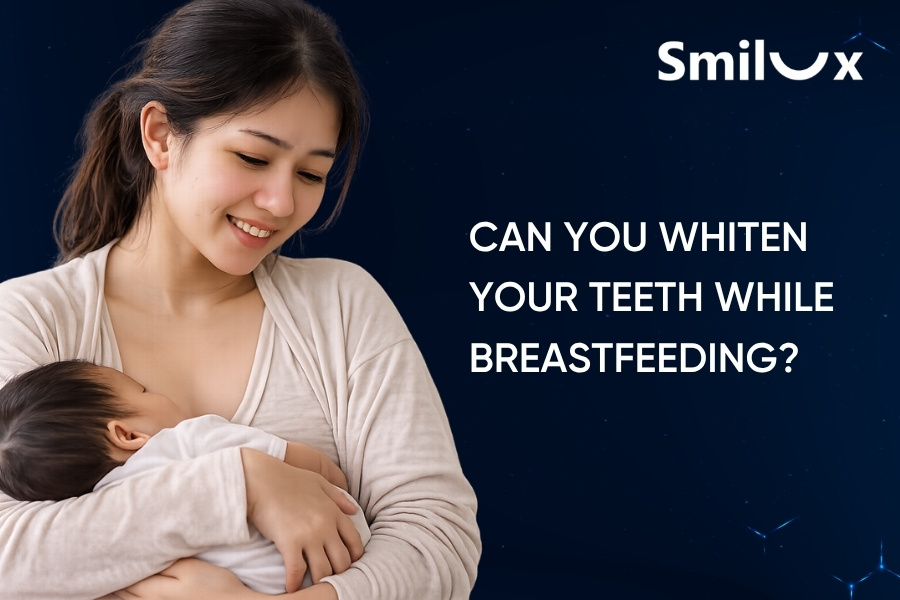 Can you whiten your teeth while breastfeeding? Can you whiten your teeth while breastfeeding?