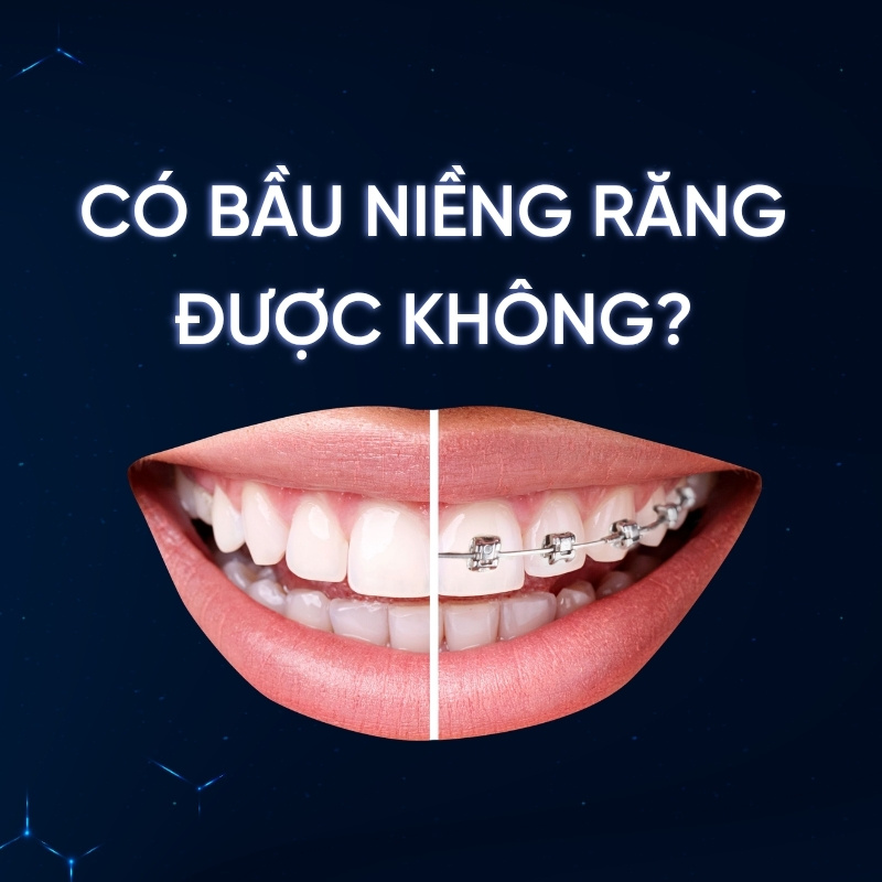 Có bầu niềng răng được không smilux dental