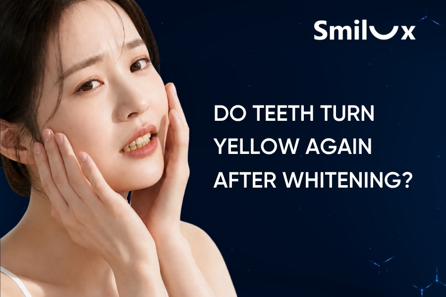 Do Teeth Turn Yellow Again After Whitening? Do Teeth Turn Yellow Again After Whitening smilux dental