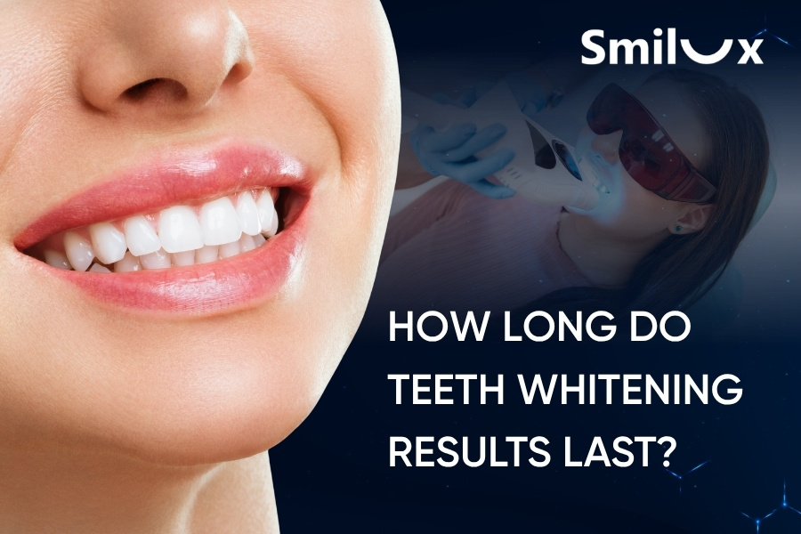 How Long Do Teeth Whitening Results Last? How Often Should You Whiten Your Teeth?