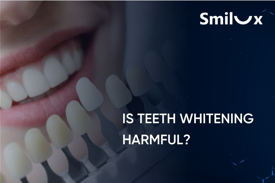 Is Teeth Whitening Harmful? Should You Get Teeth Whitening? Is Teeth Whitening Harmful? Should You Get Teeth Whitening?