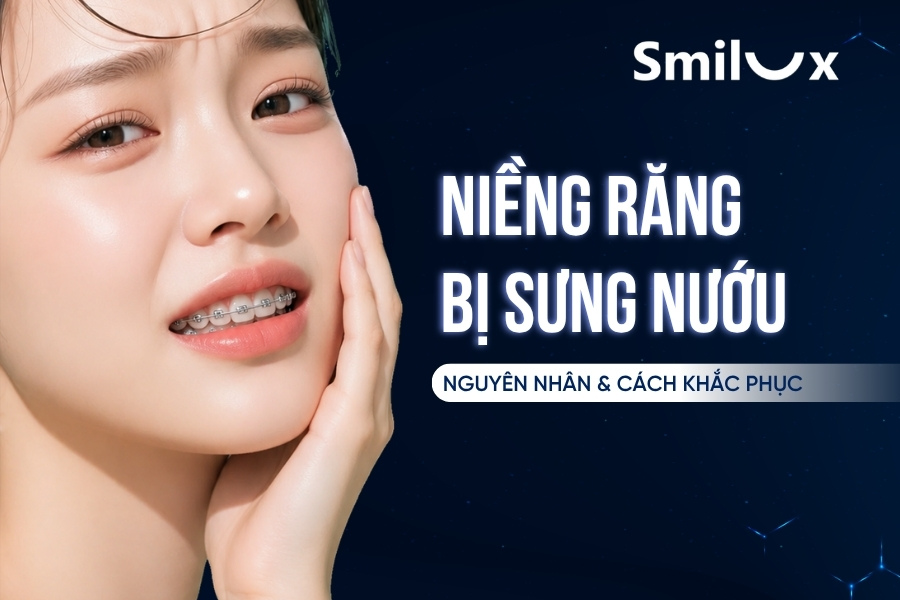 Niềng răng bị sưng nướu, viêm lợi: Nguyên nhân và cách khắc phục Niềng răng bị sưng nướu smilux