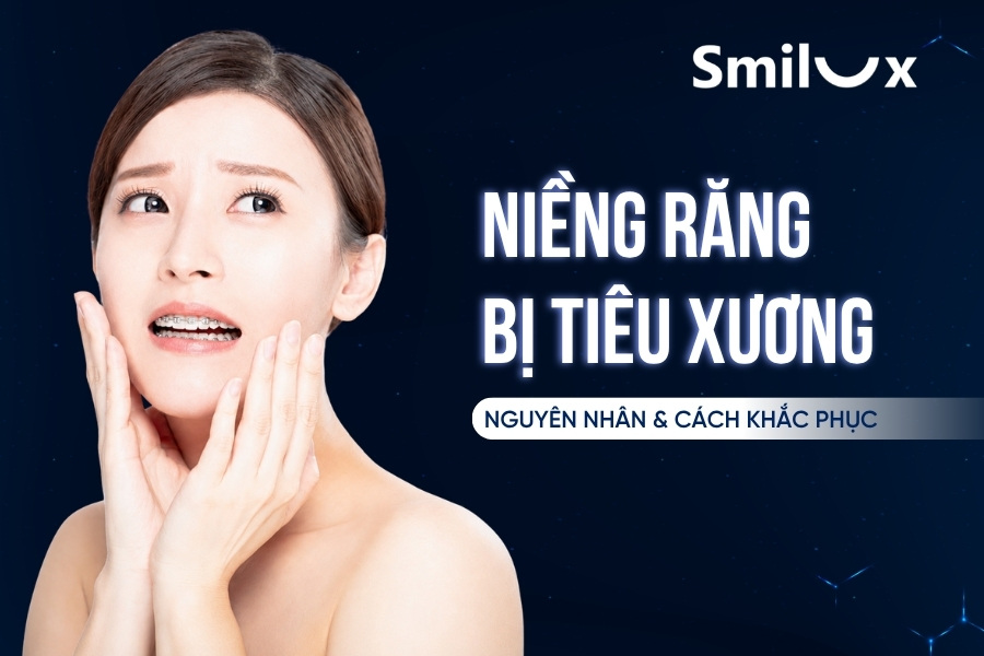 Niềng răng bị tiêu xương: Dấu hiệu, nguyên nhân và cách khắc phục Niềng răng bị tiêu xương: Dấu hiệu, nguyên nhân và cách khắc phục