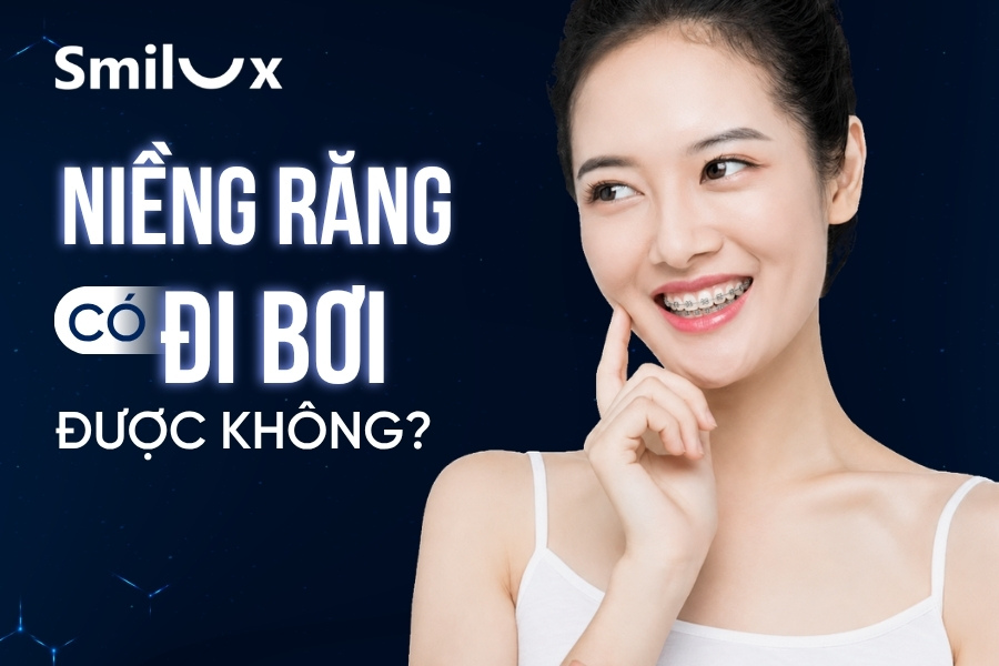 Niềng răng có đi bơi được không smilux Niềng răng có đi bơi được không smilux