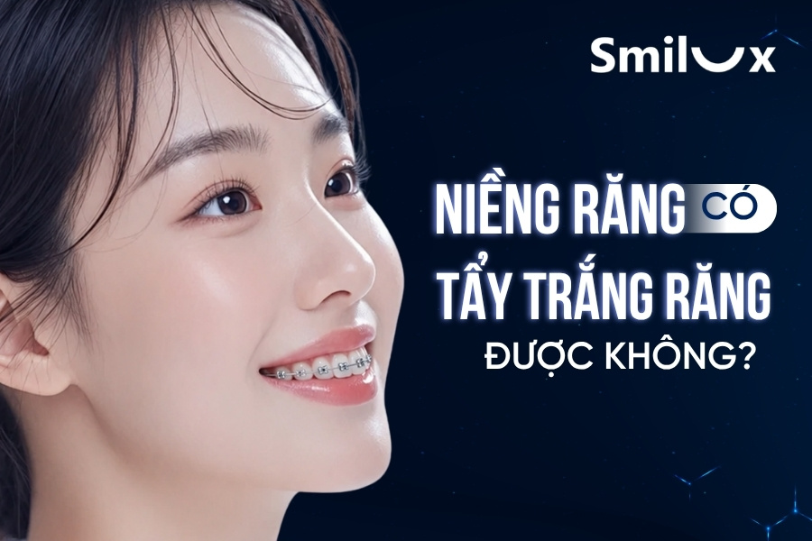 Niềng răng có tẩy trắng răng được không smilux