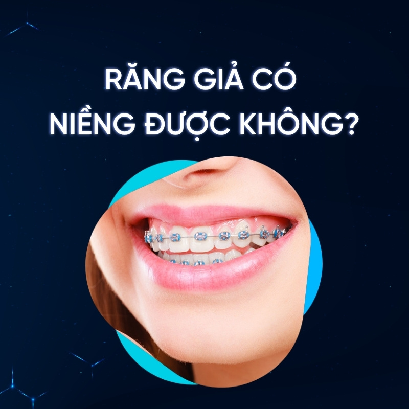 Răng giả có niềng được không smilux dental