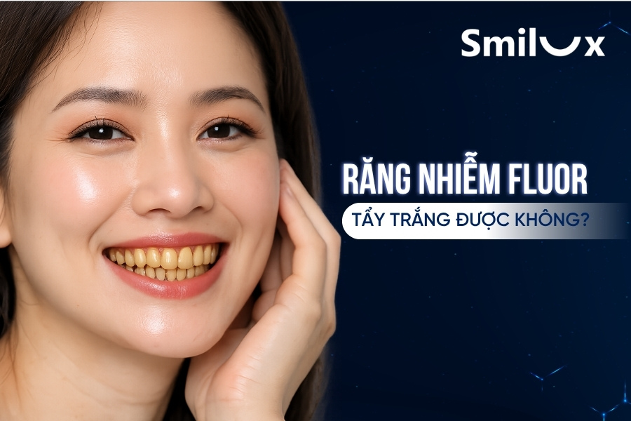 Răng nhiễm Fluor tẩy trắng​ được không?