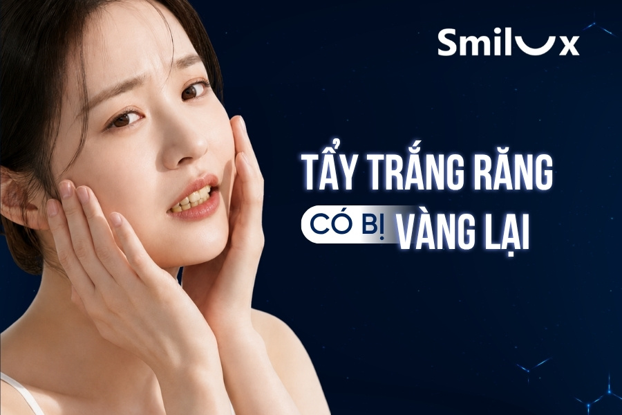Tẩy trắng răng có bị vàng lại không smilux dental
