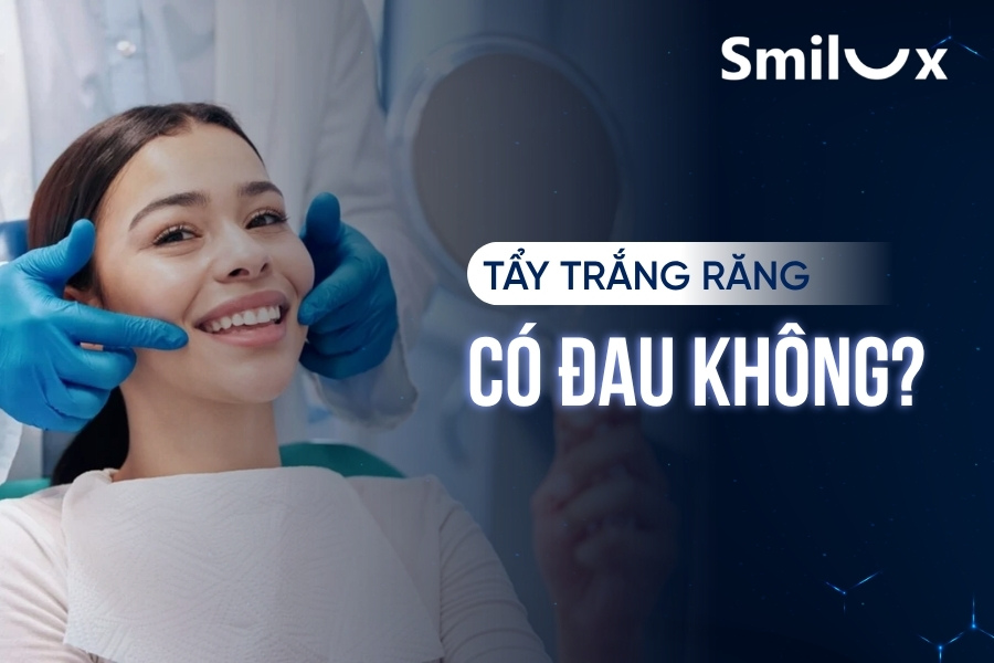 Tẩy trắng răng có đau không? Bác sĩ Smilux giải đáp chi tiết Tẩy trắng răng có đau không? Bác sĩ Smilux giải đáp chi tiết