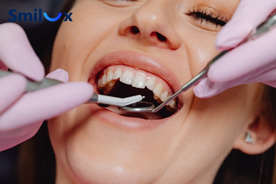 Mão sứ kín khít giúp niềng răng an toàn hơn Mão sứ kín khít giúp niềng răng an toàn hơn