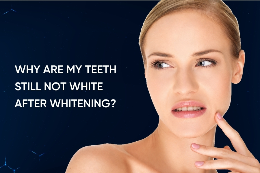 Why Are My Teeth Still Not White After Whitening? Why Are My Teeth Still Not White After Whitening?