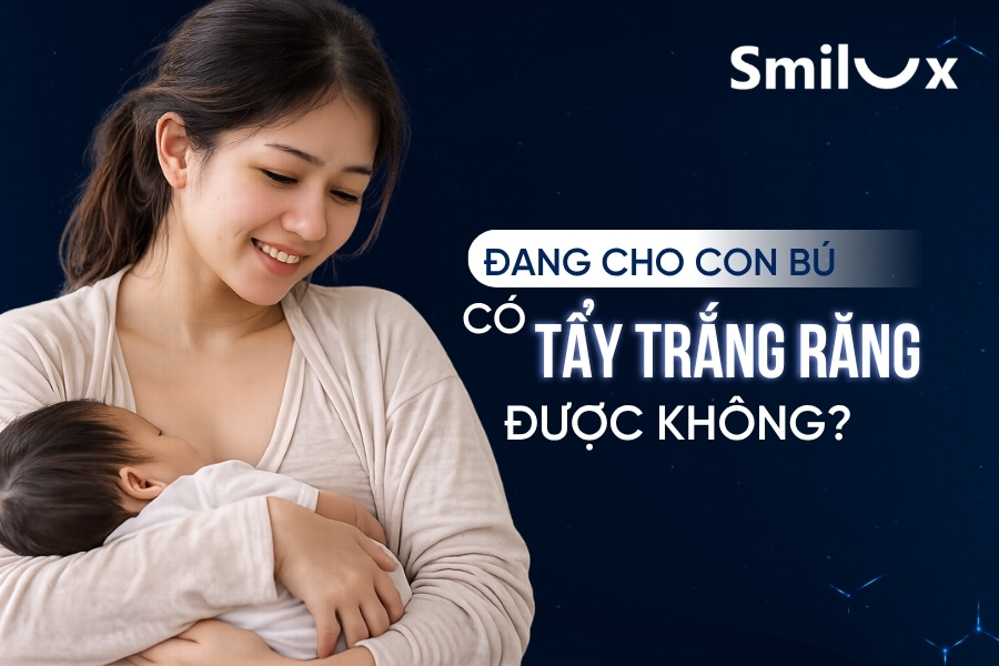 Đang cho con bú có tẩy trắng răng được không? Smilux giải đáp Đang cho con bú có tẩy trắng răng được không? Smilux giải đáp