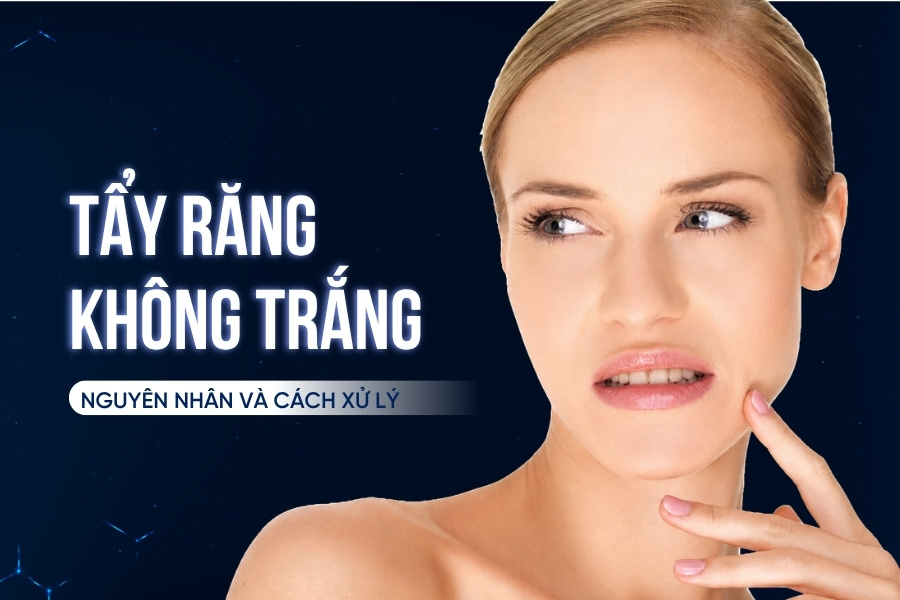 Tại sao tẩy răng không trắng? Nguyên nhân và cách xử lý Tại sao tẩy răng không trắng? Nguyên nhân và cách xử lý