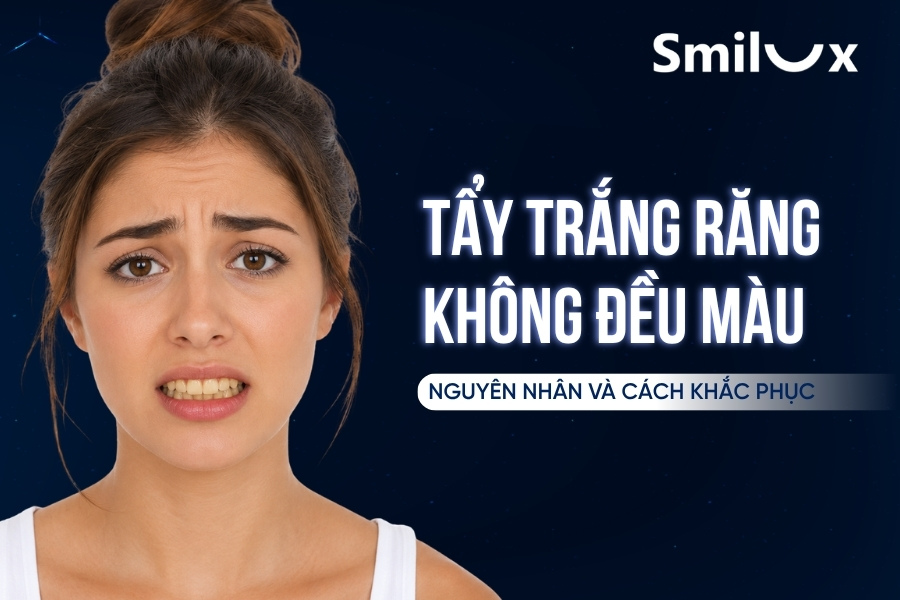 Tẩy trắng răng không đều màu: Nguyên nhân và cách khắc phục hiệu quả Tẩy trắng răng không đều màu: Nguyên nhân và cách khắc phục hiệu quả