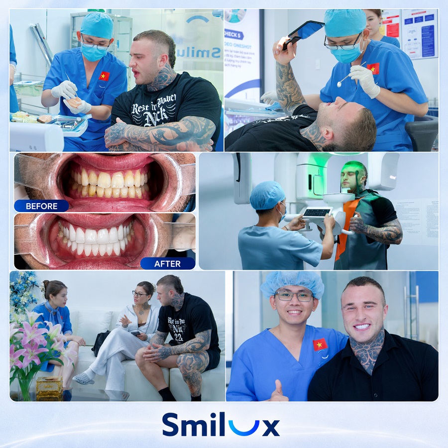 ảnh website smilux en 2